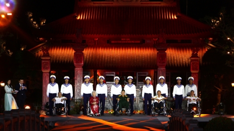 ລາຍ​ການ​ສະ​ແດງ​ສິ​ລະ​ປະ​ກ​ານ​ເມືອງ “ບົດ​ເພງ​ອຳ​ມະ​ຕະ​ຢູ່​ແມ່​ນ້ຳ” ທີ່​ຝັງ​ເລິກ​ໃນ​ໃຈ