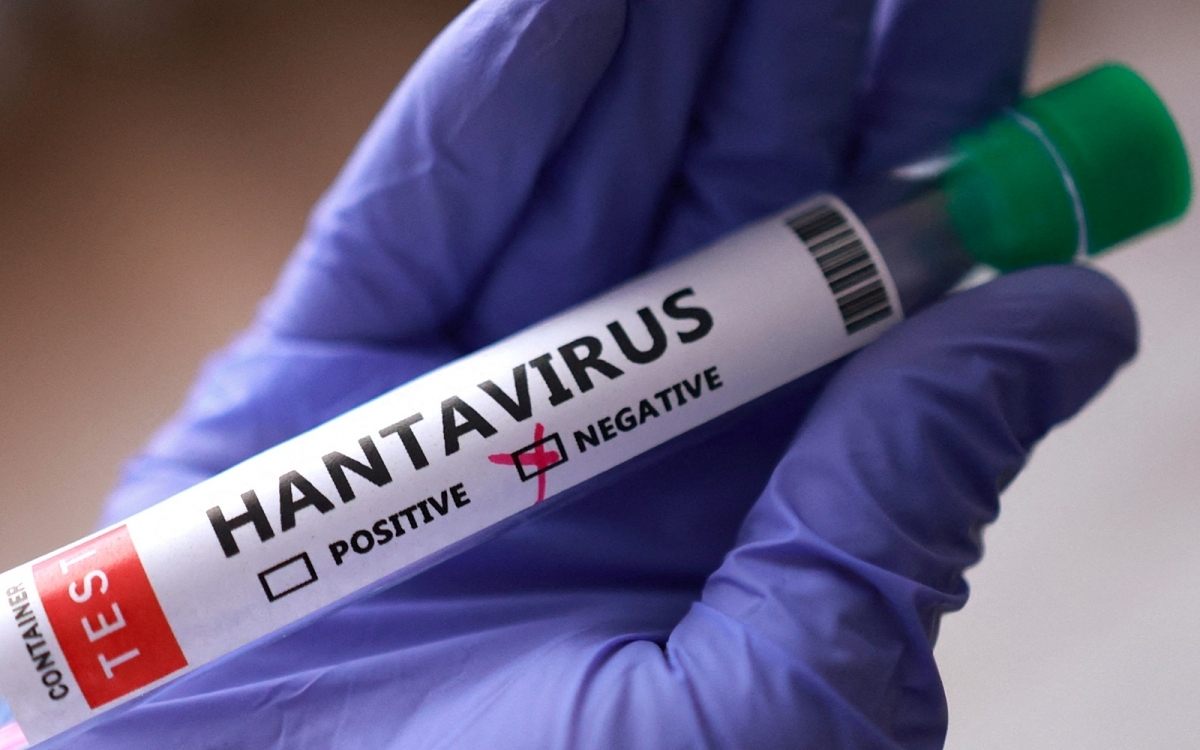 Test von Hantavirus. (Foto: REUTERS)