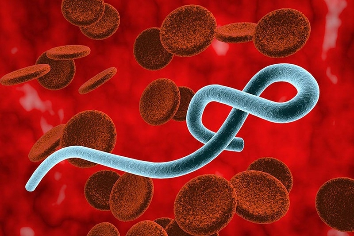 Gambar virus Ebola. Foto: medlatec.vn
