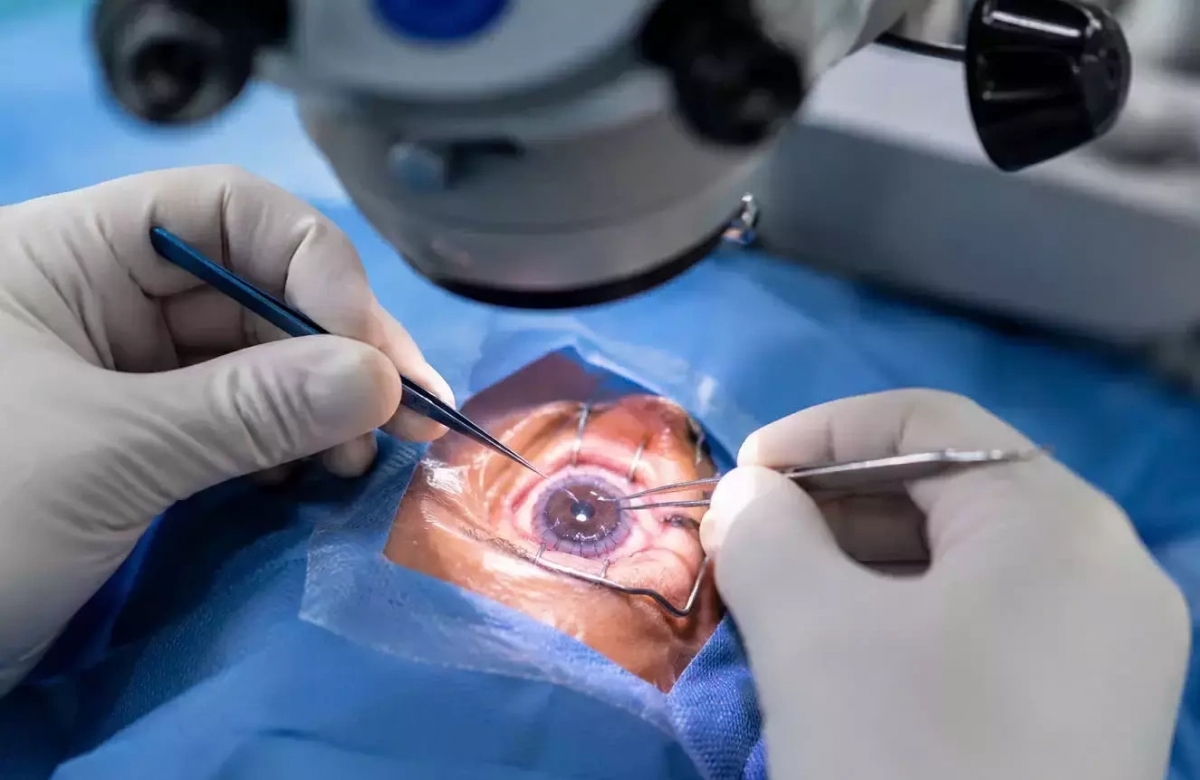 Eine Hornhauttransplantation bei Menschen. (Foto: VGCT)