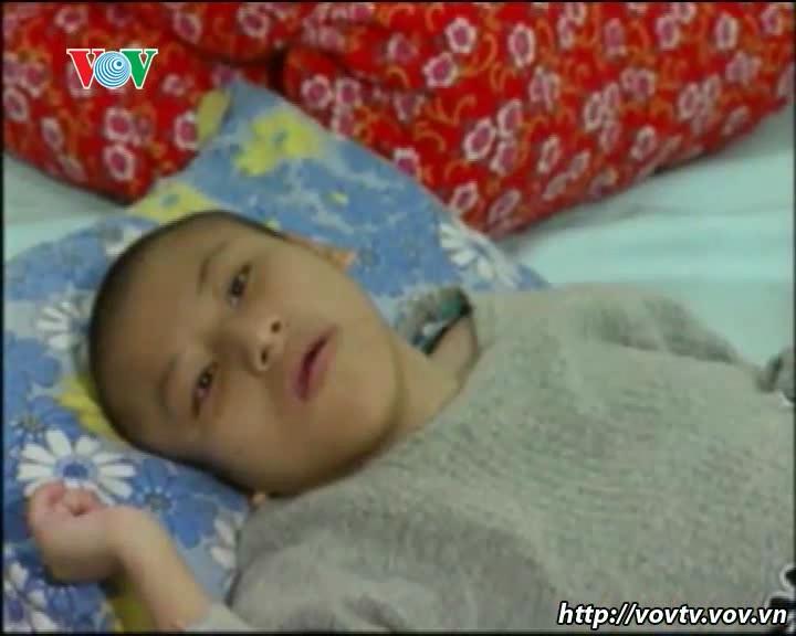 ベトナム人枯葉剤被害者の痛みを癒すための努力