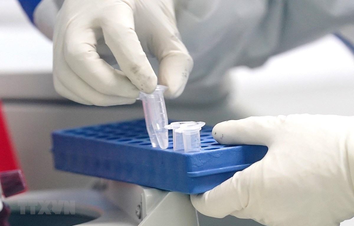 Japan unterstützt das Pasteur-Institut in Ho-Chi-Minh-Stadt bei der Reaktion auf Covid-19-Epidemie