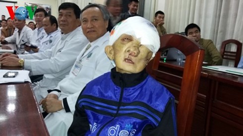 "cu gia mat quy" khong con khoi u khong lo tren mat hinh 0