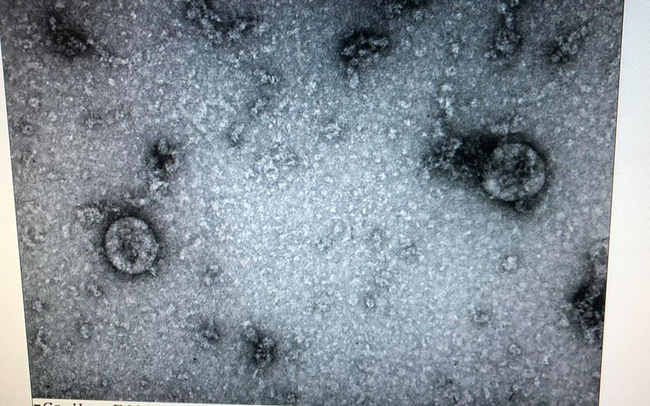 Vietnam logra recrear coronavirus de nuevo tipo