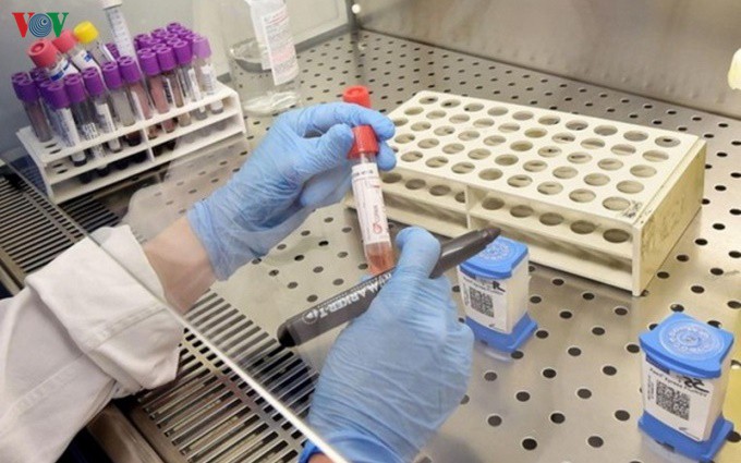 Vietnam estudia aplicación suplementaria de medicamento para VIH/SIDA en tratamiento de coronavirus