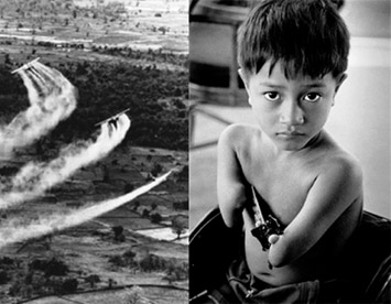 ดูแลชีวิตความเป็นอยู่ให้แก่ผู้เคราะห์ร้ายจากสารพิษสีส้มไดอ๊อกซินเวียดนาม