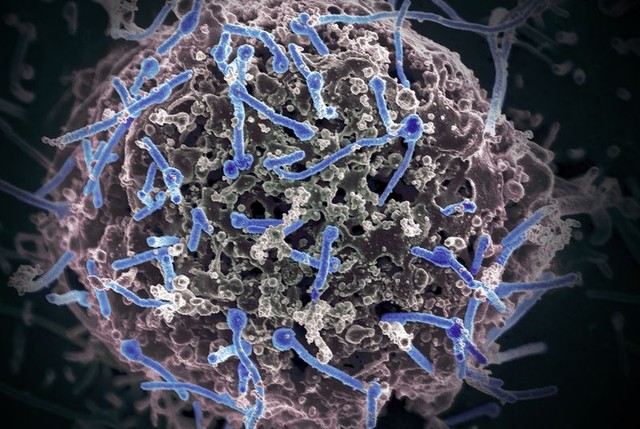 베트남, 에볼라 바이러스 사례 보고 아직 없다.