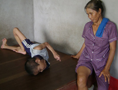 Борьба за справедливость для жертв дефолианта "эйджент-оранж"