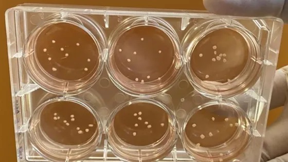 Кислородная терапия помогла замедлить болезнь Альцгеймера