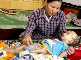 Partido del Trabajo de México apoya víctimas vietnamitas del agente naranja