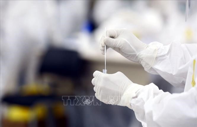 28. Juni: Vietnam betätigt 246 neue Covid-19-Infektionsfälle