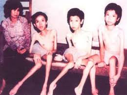 Das dioxinhaltige Entlaubungsmittel belastet das Leben der Vietnamesen