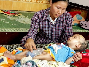 បន្តពង្រឹងគ្រឹះដ្ឋានគតិយុត្តដើម្បីស្នើអាមេរិកទទួលខុសត្រូវចំពោះការរងឥទ្ធិពលដោយជាតិគីមី Dioxin