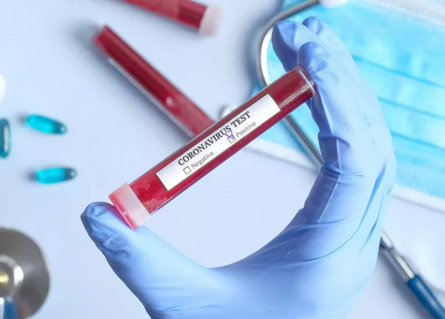 Aumentan casos de contagio del nuevo coronavirus en Vietnam